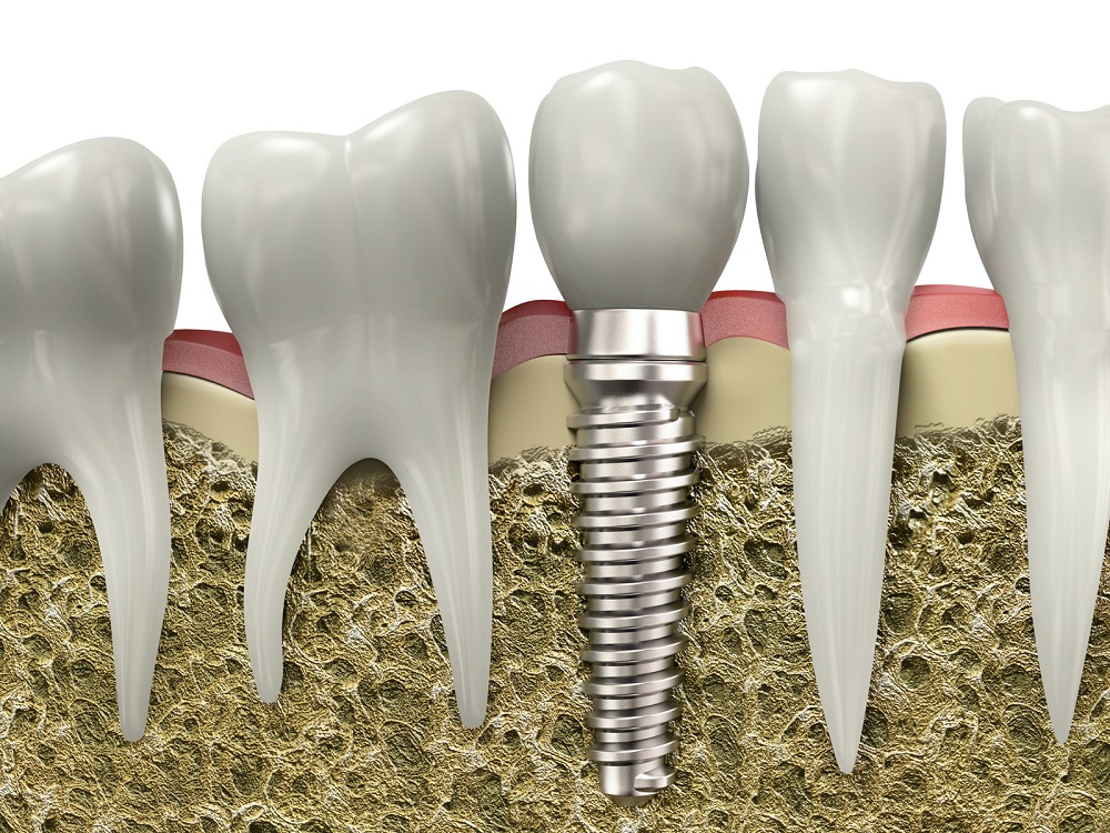 visit Colina Dental